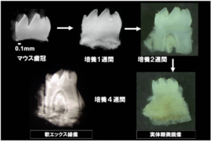 再生医療 歯髄再生について 大阪市旭区の ステラ歯科クリニック千林大宮 千林大宮駅すぐの歯医者