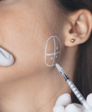 ボツリヌス・ヒアルロン酸