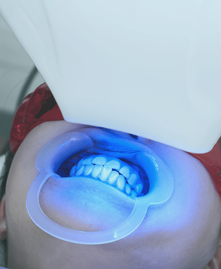 医療ホワイトニング